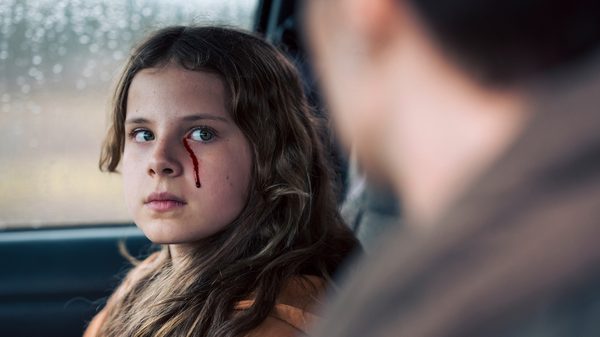 Freaks Part II film image; girl with blood on her face looking at someone else